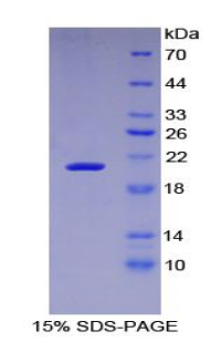 Recombinant Leukemia Inhibitory Factor Receptor (LIFR)