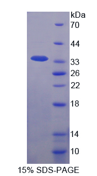 Recombinant Interleukin 1 Beta (IL1b)