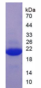 Recombinant Interleukin 1 Beta (IL1b)