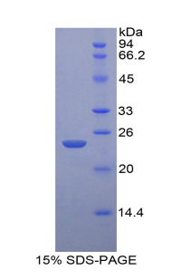 Recombinant Interleukin 1 Beta (IL1b)