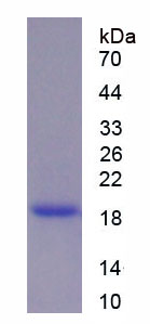 Recombinant Interleukin 1 Beta (IL1b)