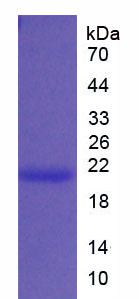 Recombinant Interleukin 1 Beta (IL1b)