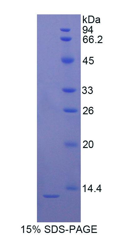 Recombinant S100 Calcium Binding Protein B (S100B)