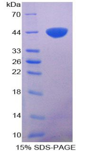 Recombinant S100 Calcium Binding Protein A11 (S100A11)