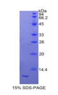 Recombinant S100 Calcium Binding Protein A11 (S100A11)