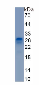 Recombinant Procollagen III N-Terminal Propeptide (PIIINP)