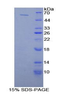 Recombinant Phospholipase A2 Activating Protein (PLAP)