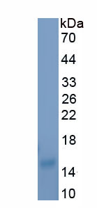Recombinant Aquaporin 9 (AQP9)