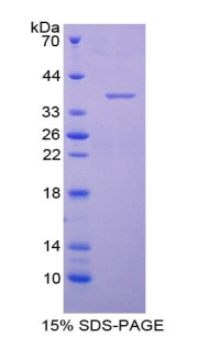 Recombinant Aquaporin 1 (AQP1)