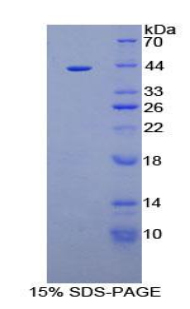 Recombinant Aquaporin 2, Collecting Duct (AQP2)