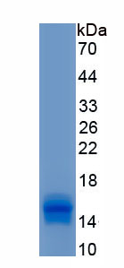 Recombinant Aquaporin 5 (AQP5)