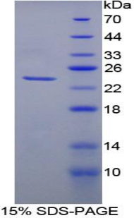 Recombinant Heme Oxygenase 1 (HO1)