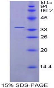 Recombinant Cyclin D1 (CCND1)