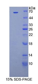 Recombinant Cyclin D1 (CCND1)