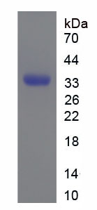 Recombinant Cyclin D1 (CCND1)