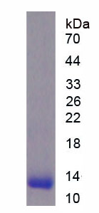 Recombinant Pyruvate kinase isozymes M2 (PKM2)