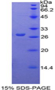 Recombinant Pyruvate kinase isozymes M2 (PKM2)