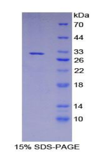 Recombinant Heme Oxygenase 2, Decycling (HO2)