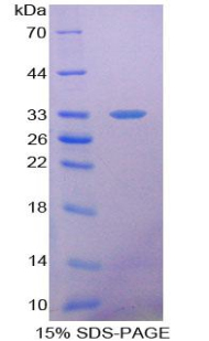 Recombinant Heme Oxygenase 2, Decycling (HO2)