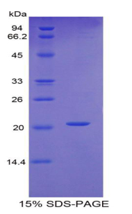 RPA593Hu04.jpg