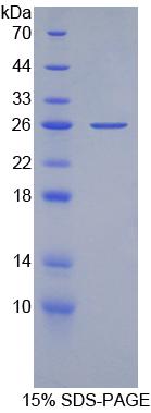 Recombinant Apolipoprotein B100 (APOB100)