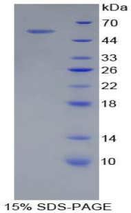 Recombinant Adiponectin (ADPN)