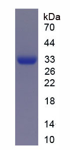 Recombinant Adiponectin (ADPN)