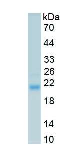 Recombinant Neuroglobin (NGB)