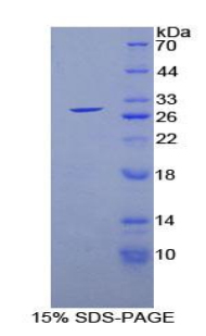 Recombinant Glutathione S Transferase Alpha 1 (GSTa1)