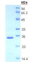 Recombinant Thrombospondin 1 (THBS1)