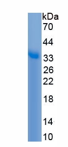 Recombinant Carboxypeptidase B2 (CPB2)