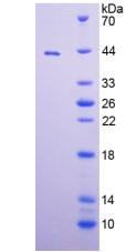 Recombinant A Disintegrin And Metalloprotease 8 (ADAM8)