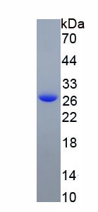 Recombinant Glutathione S Transferase Theta 1 (GSTt1)