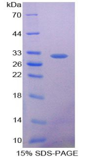 Recombinant Glutathione S Transferase Theta 1 (GSTt1)