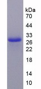 Recombinant Caspase 9 (CASP9)