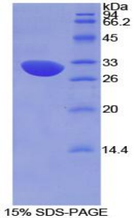 Recombinant Complement Factor H (CFH)