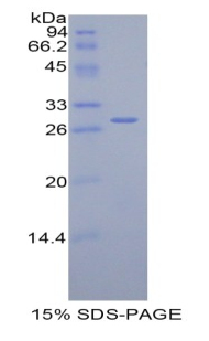 Recombinant Complement Factor H (CFH)