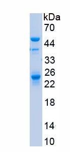 Recombinant Hexosaminidase B Beta (HEXb)