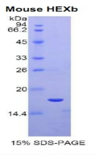 Recombinant Hexosaminidase B Beta (HEXb)