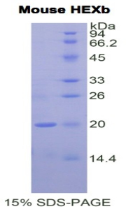 Recombinant Hexosaminidase B Beta (HEXb)