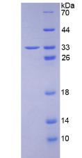 Recombinant Complement component 1 Q subcomponent-binding protein, mitochondrial (C1QBP)