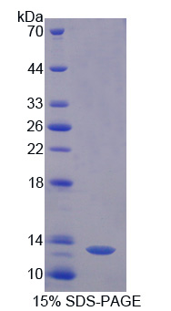 RPA656Po01.jpg