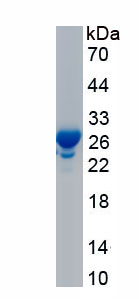 Recombinant Glutathione S Transferase Mu 2 (GSTM2)