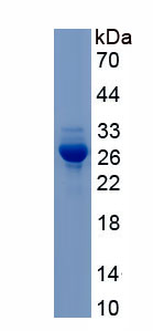 Recombinant Glutathione S Transferase Mu 2 (GSTM2)