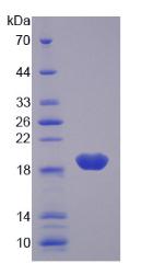 Recombinant Interleukin 7 (IL7)