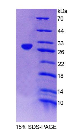 Recombinant Glucokinase (GCK)