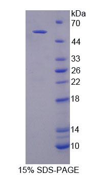 Recombinant Glucokinase (GCK)