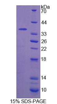 Recombinant Coagulation Factor V (F5)