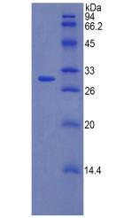 Recombinant Coagulation Factor V (F5)