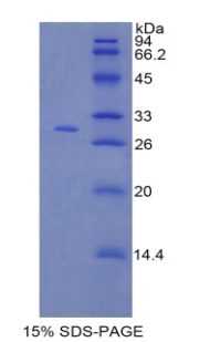 Recombinant Coagulation Factor V (F5)